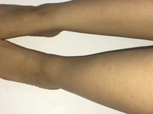 normal-left-ankle