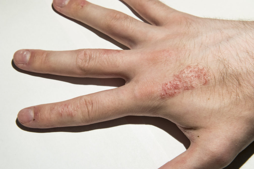 i-have-a-skin-disease-but-no-idea-what-it-is-ask-a-doctor-free