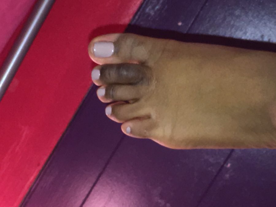 My toe got blacker and it's swollen I don't know what the problem is